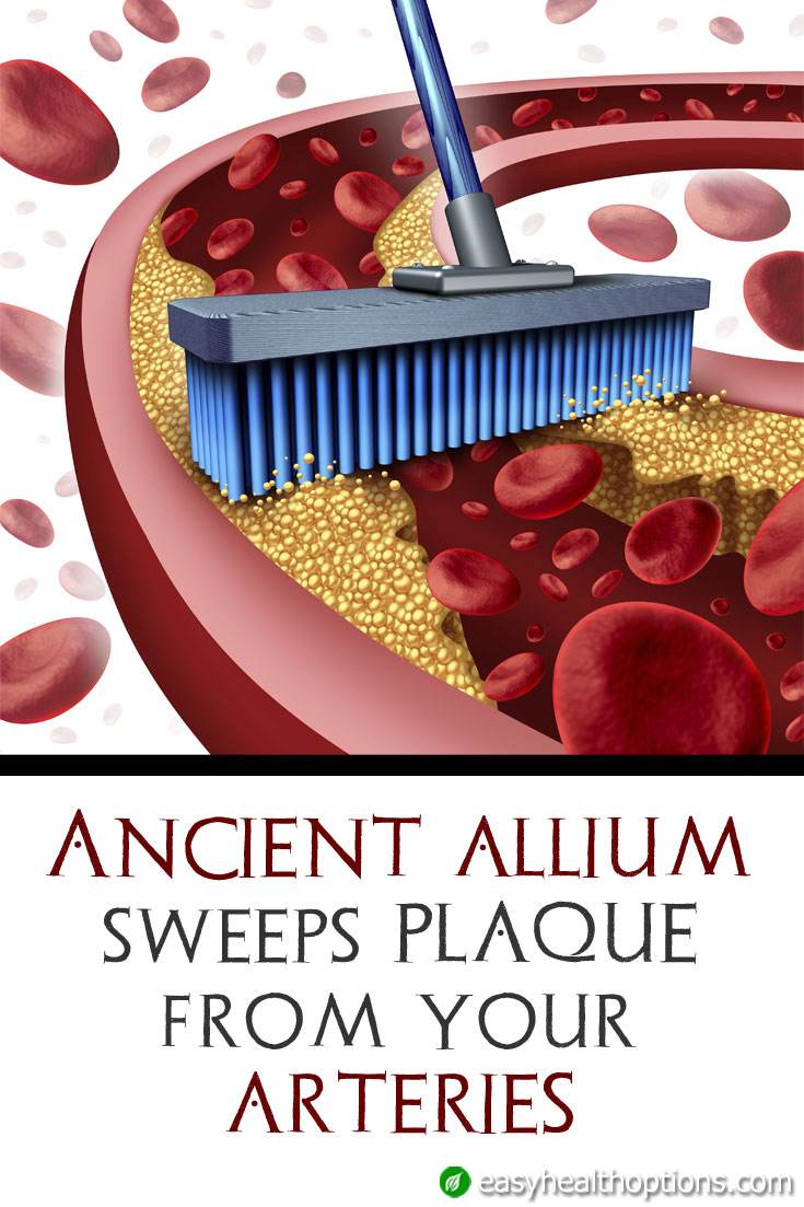 Garlic supplement sweeps plaque from your arteries