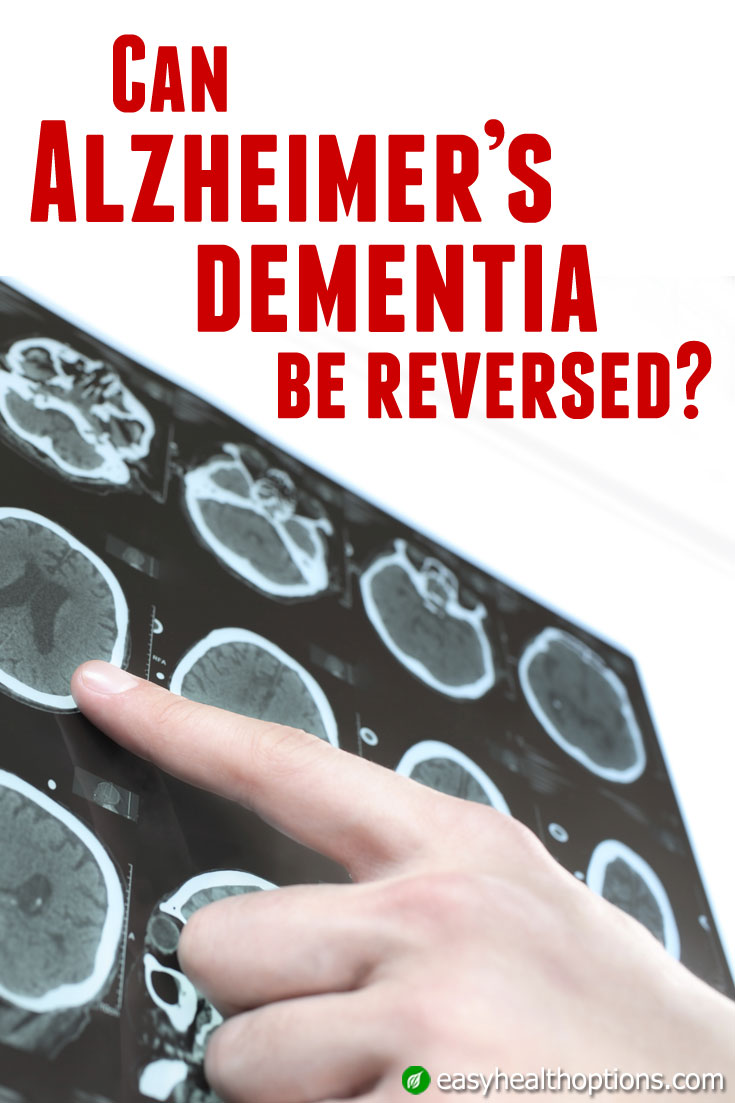 Can Alzheimer's dementia be reversed? Easy Health Options®