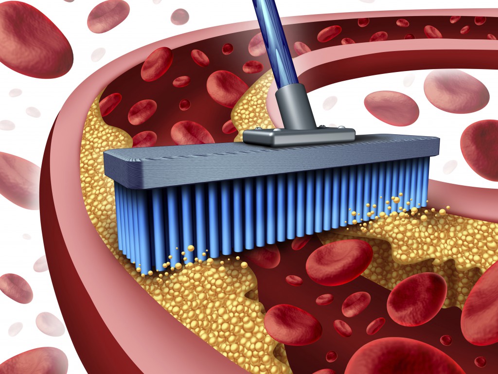 Garlic supplement sweeps plaque from your arteries