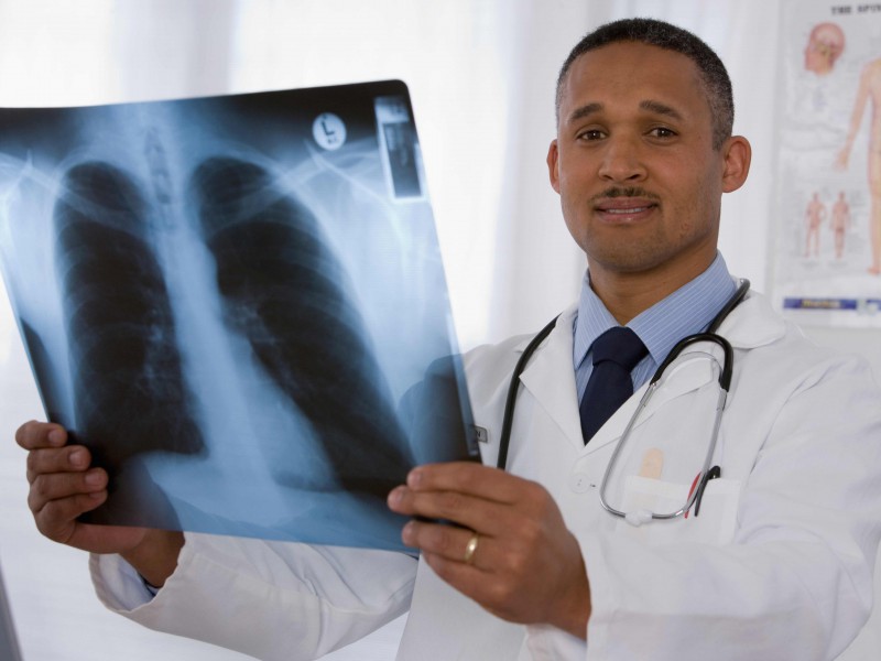 Doctor holding x-ray