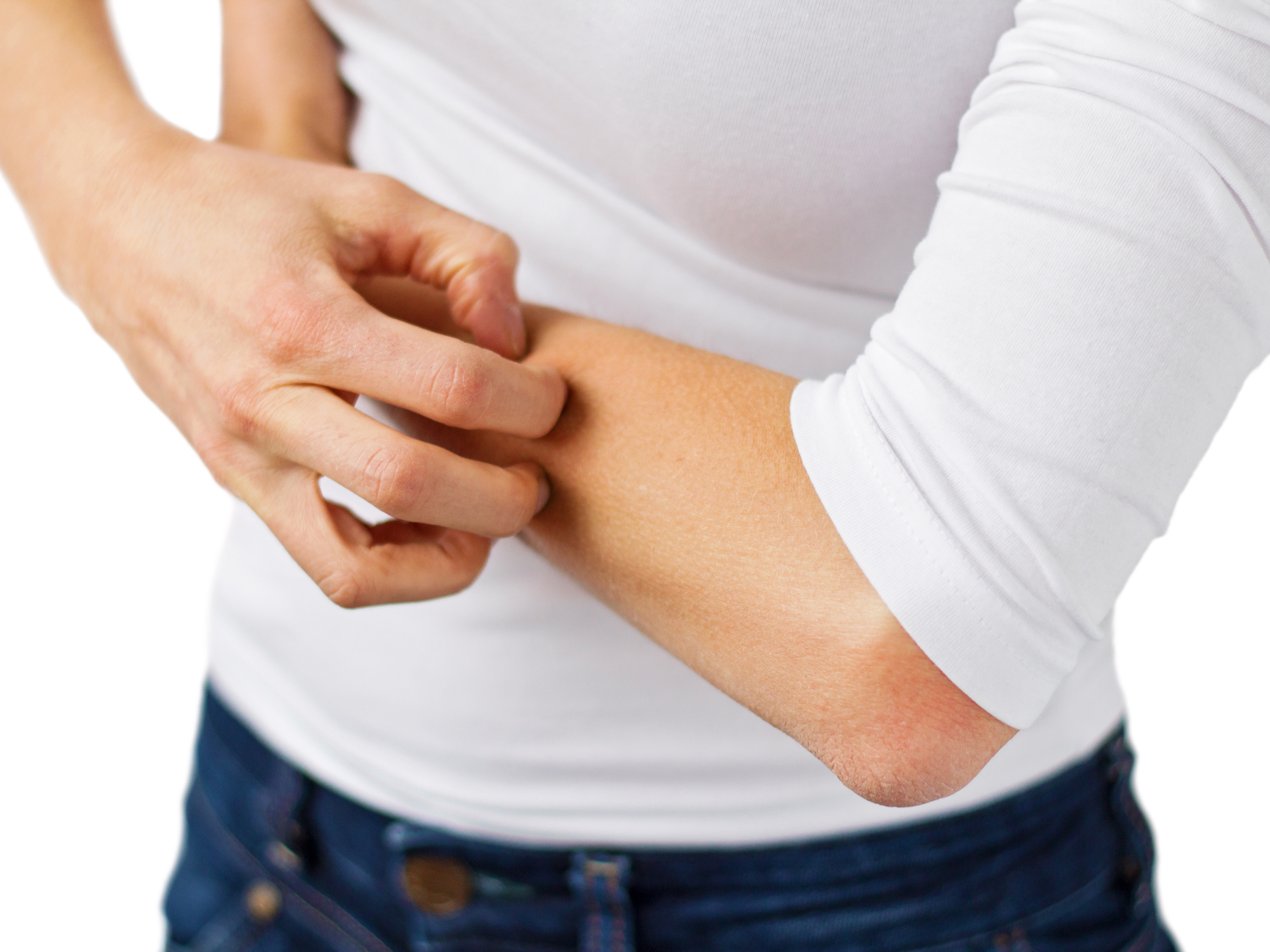 5 reasons eczema is more than skin deep