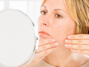 woman with acne