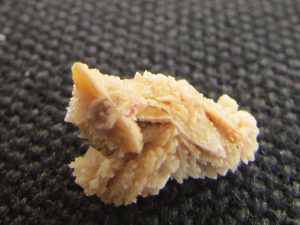 Kidney stone