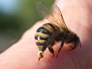 Bee sting