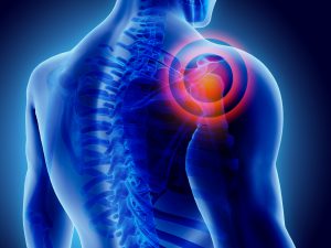 Frozen shoulder