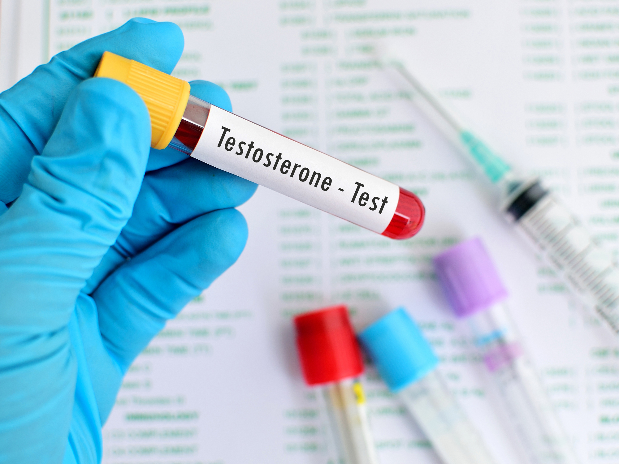 Testosterone levels: What’s normal?