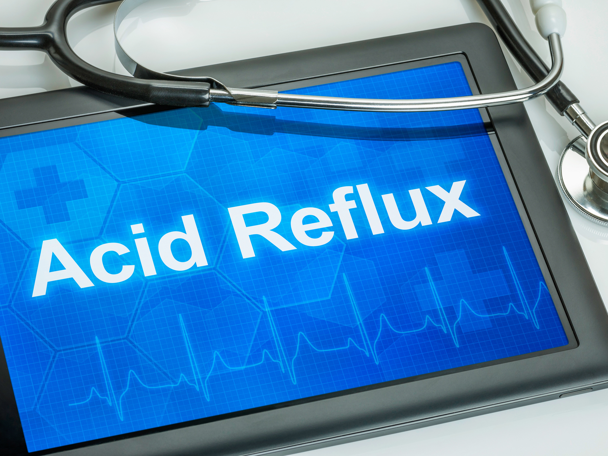 4 reflux remedies that won’t give you a stroke