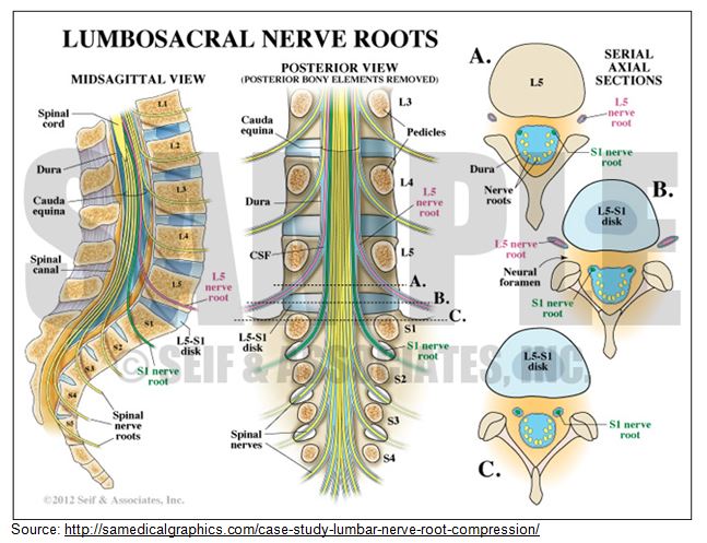 Lumbosacral Nerve Roots