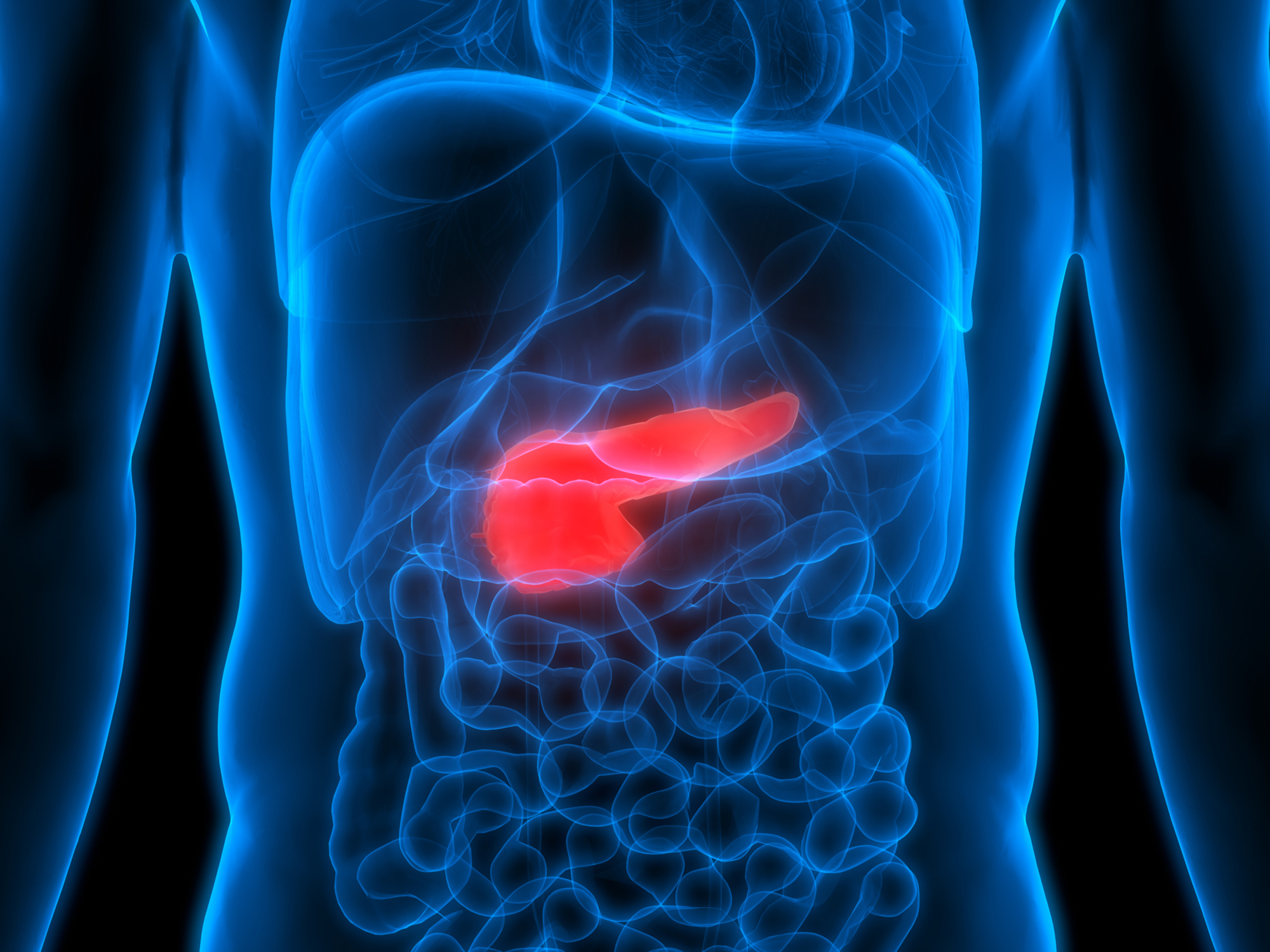 Does type 2 diabetes set you up for the deadliest of cancers?