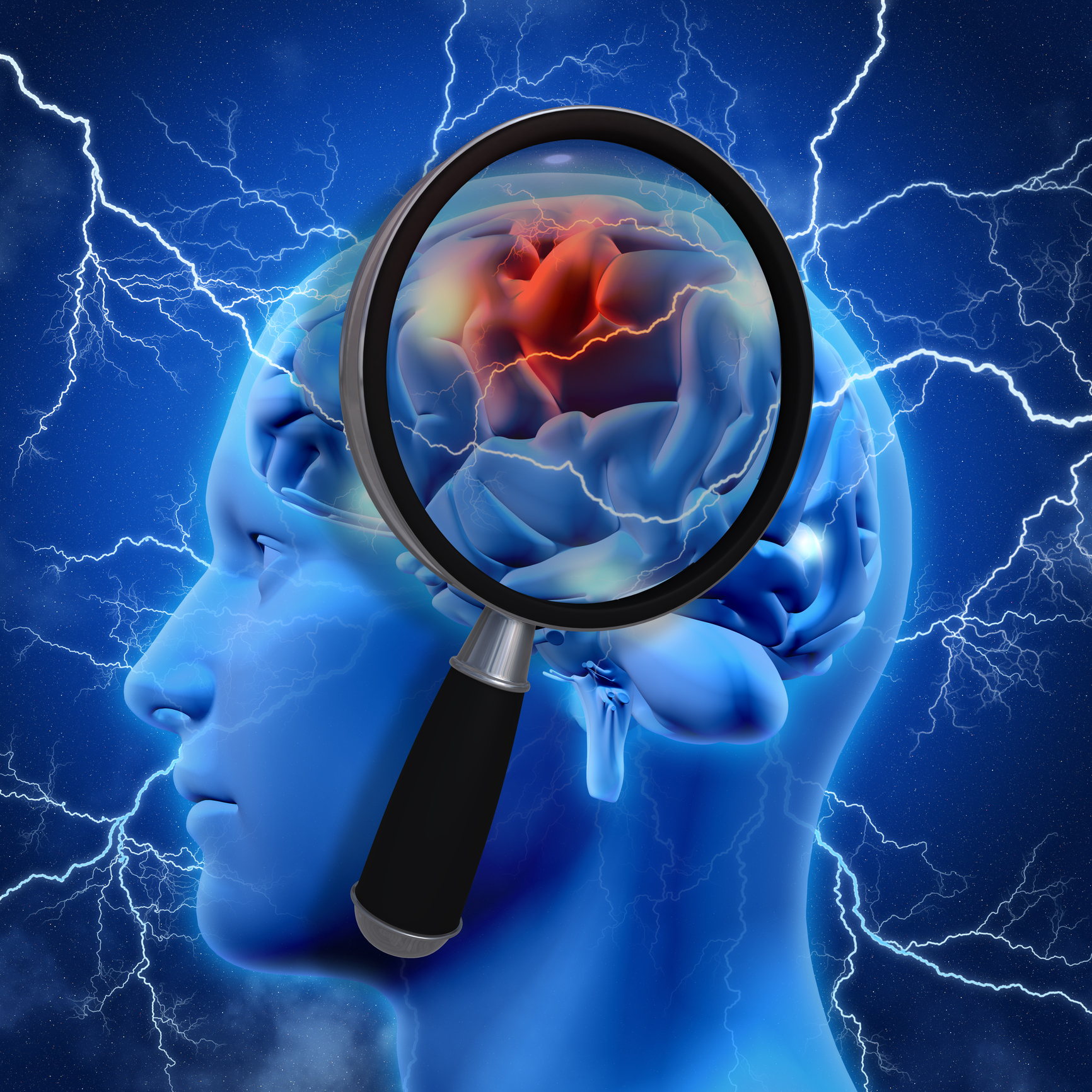 The other high blood pressure brain danger besides stroke
