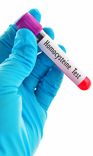 Homocysteine blood tests