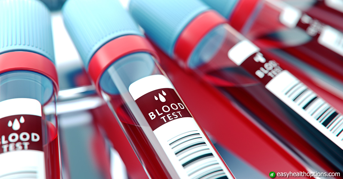 4 blood tests to prevent heart disease and stroke Easy Health Options®