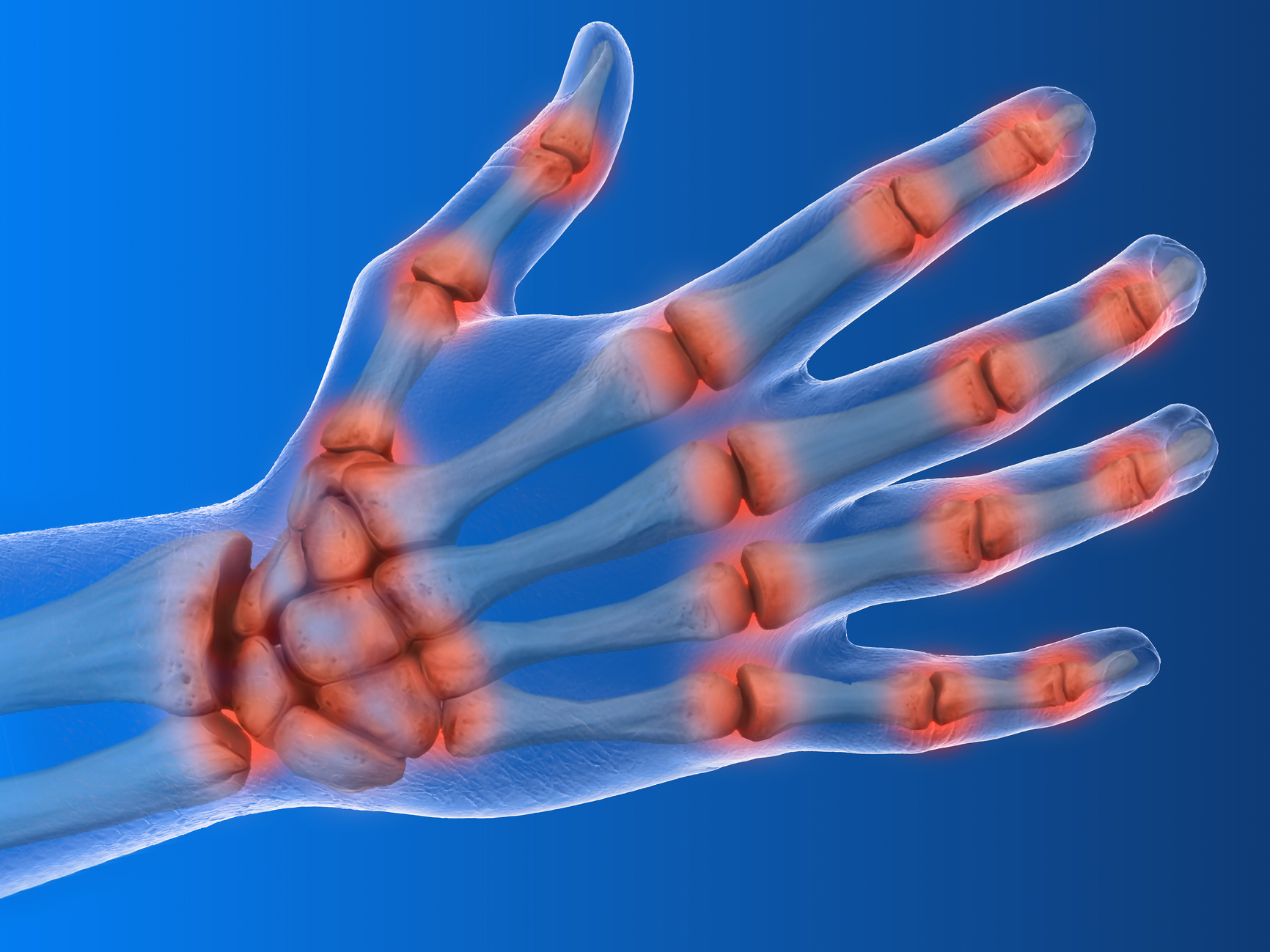 5 reasons your hands could be hurting