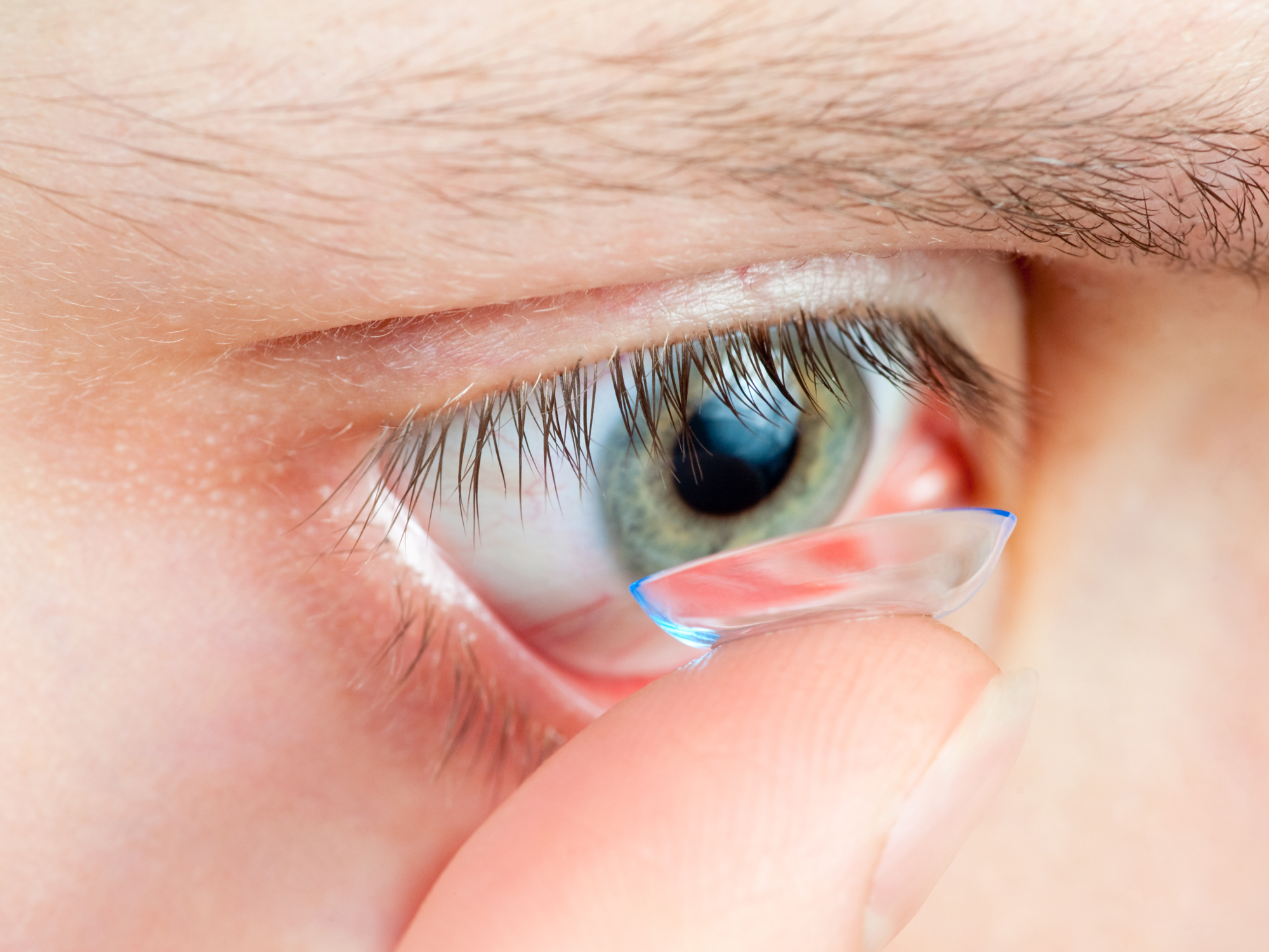 The contact lens infection that can steal your sight