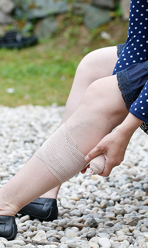 Woman wrapping leg ulcer