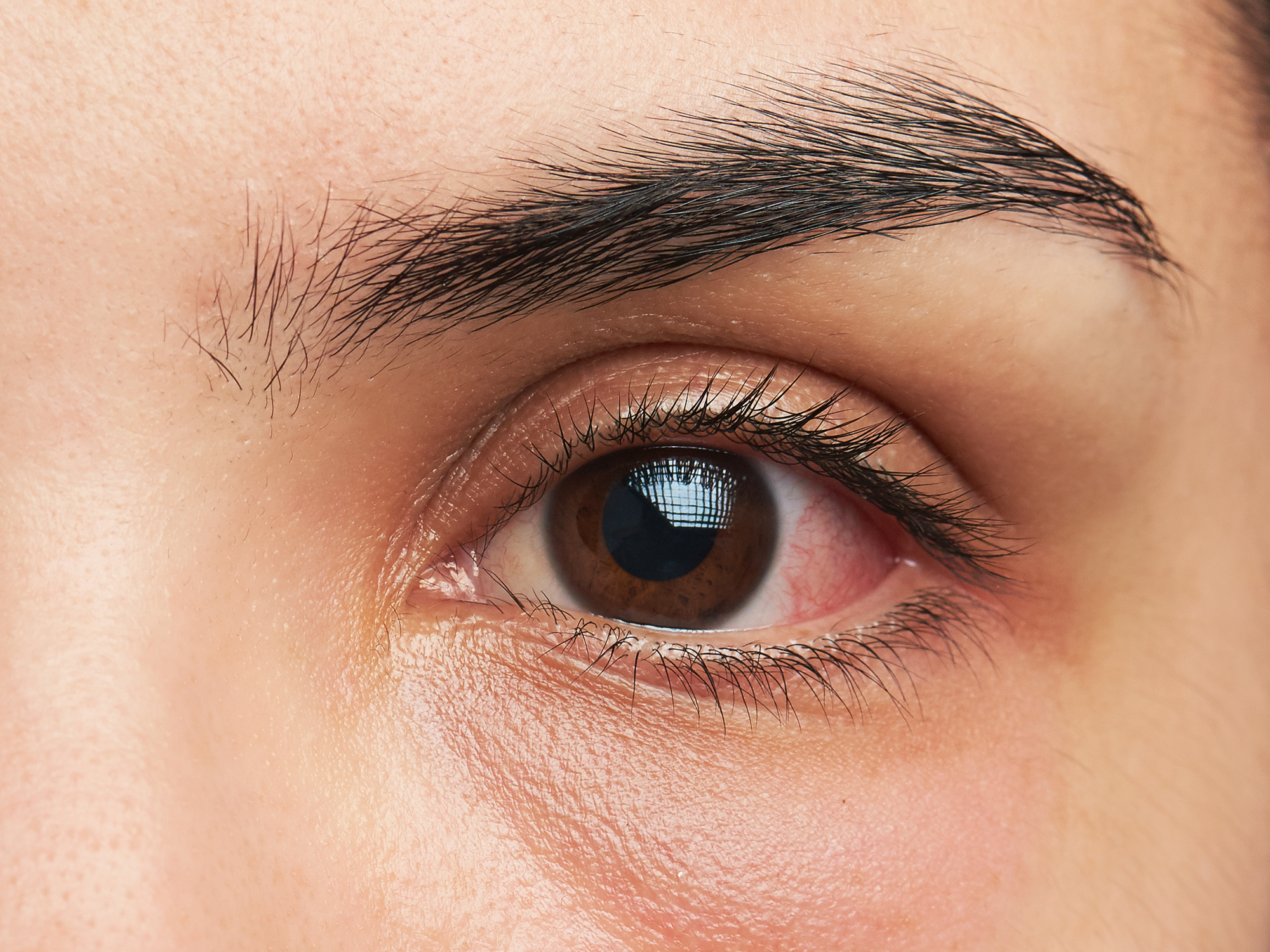 Are your eye symptoms serious? Here’s how to tell