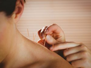 Menopause symptoms you can treat with acupuncture