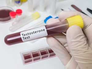 Testosterone replacement therapy