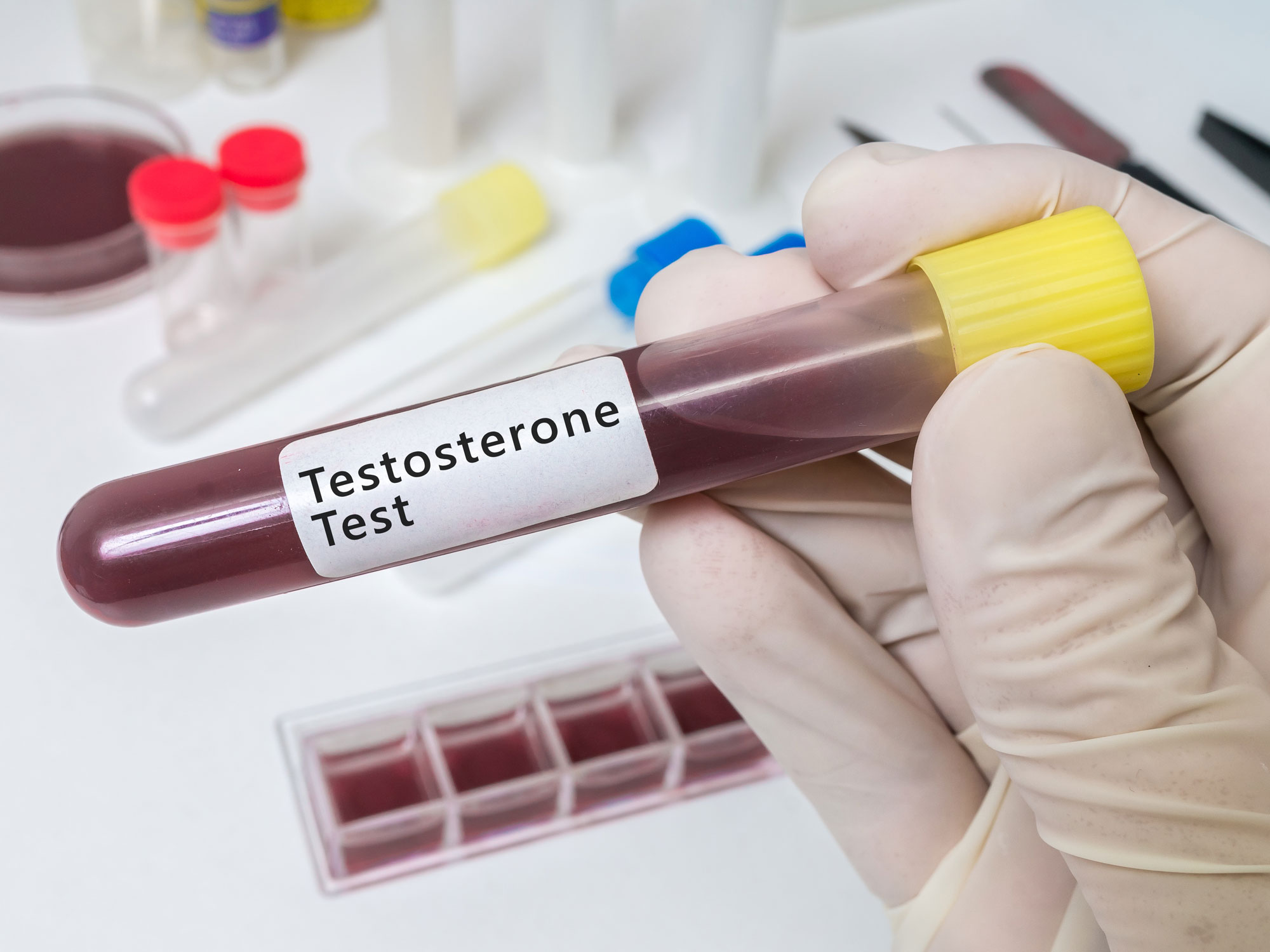 Are the benefits of testosterone replacement for you?