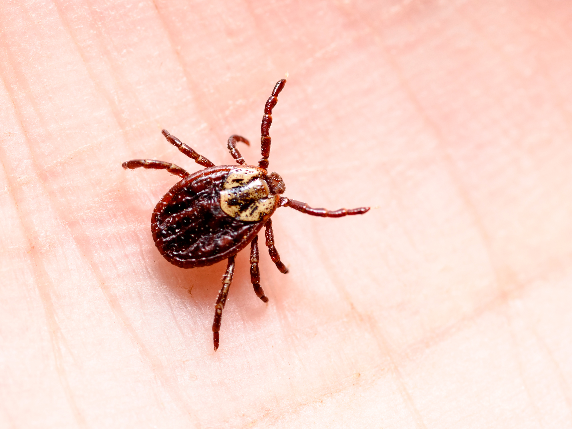 AGS danger from ticks is greater than expected 