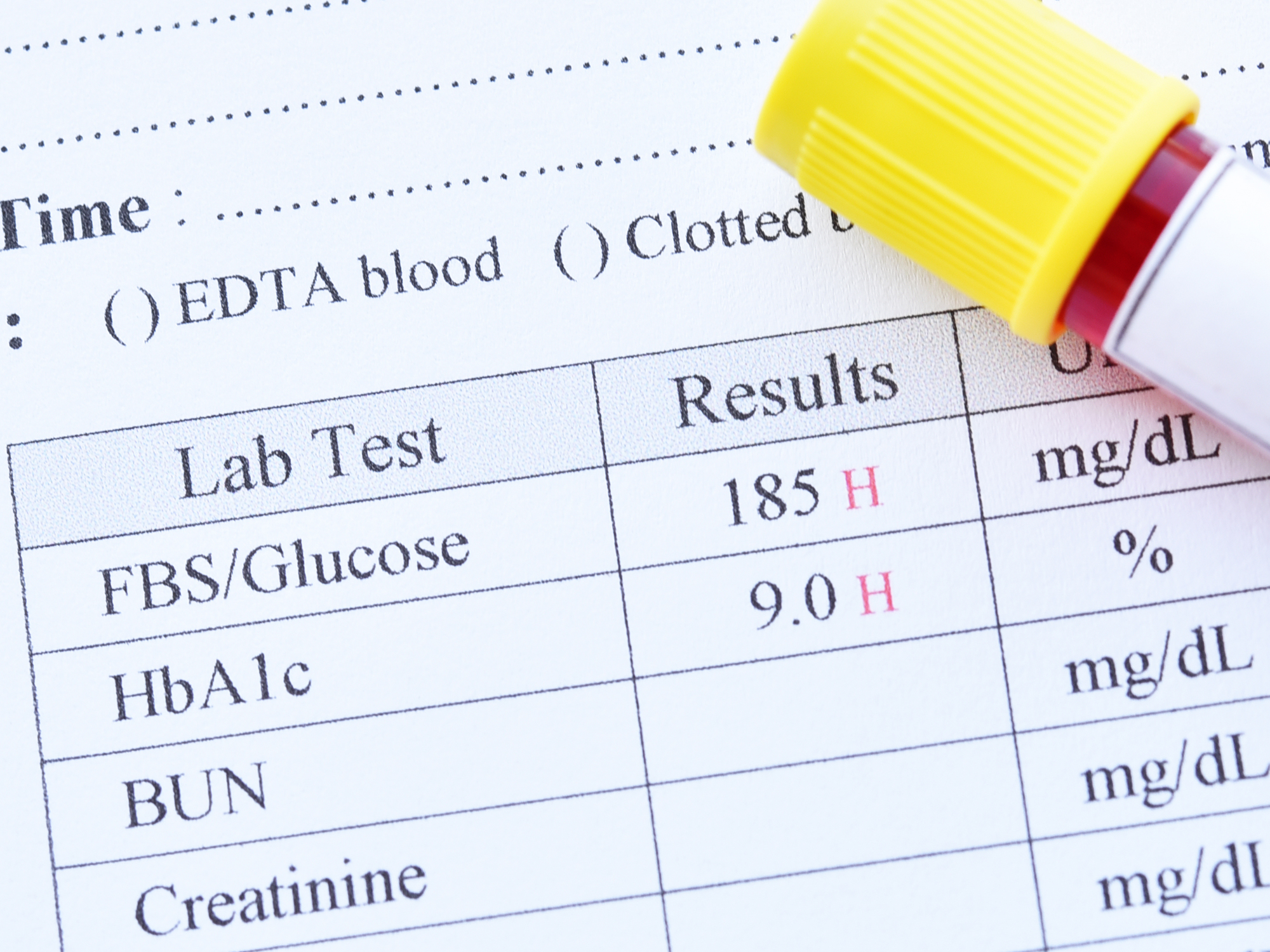 Did the ‘gold standard’ diabetes test that’s mostly wrong miss your diagnosis?