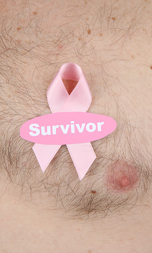 Breast cancer in men