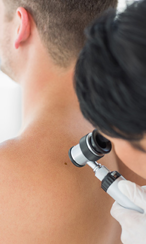 Skin cancer examination