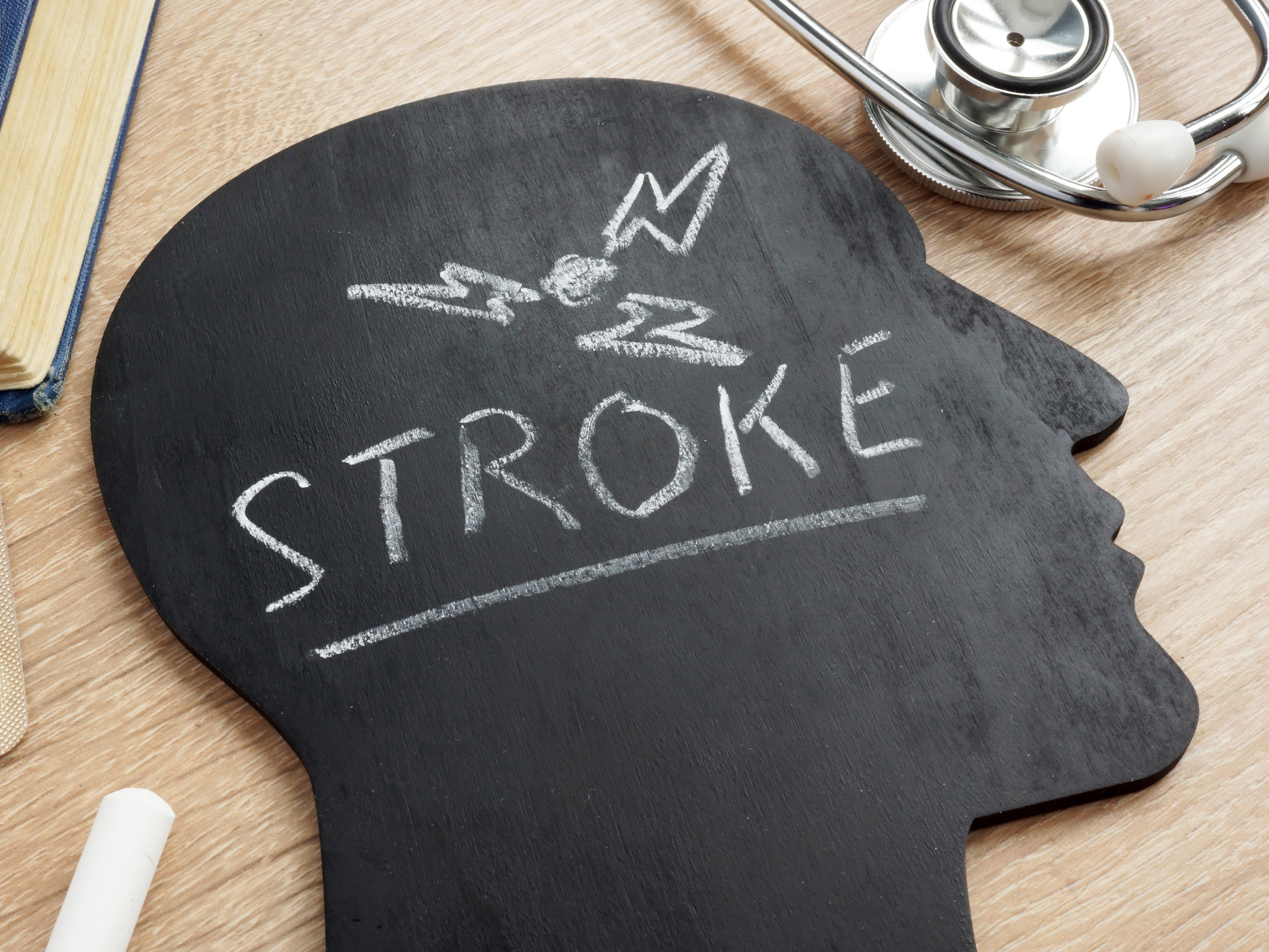 The surprising thing that could slow getting help after a stroke