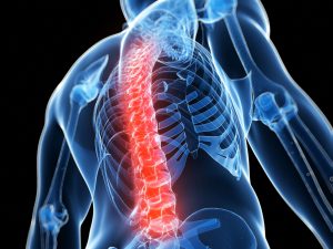 Is your back pain a sign of Ankylosing Spondylitis?