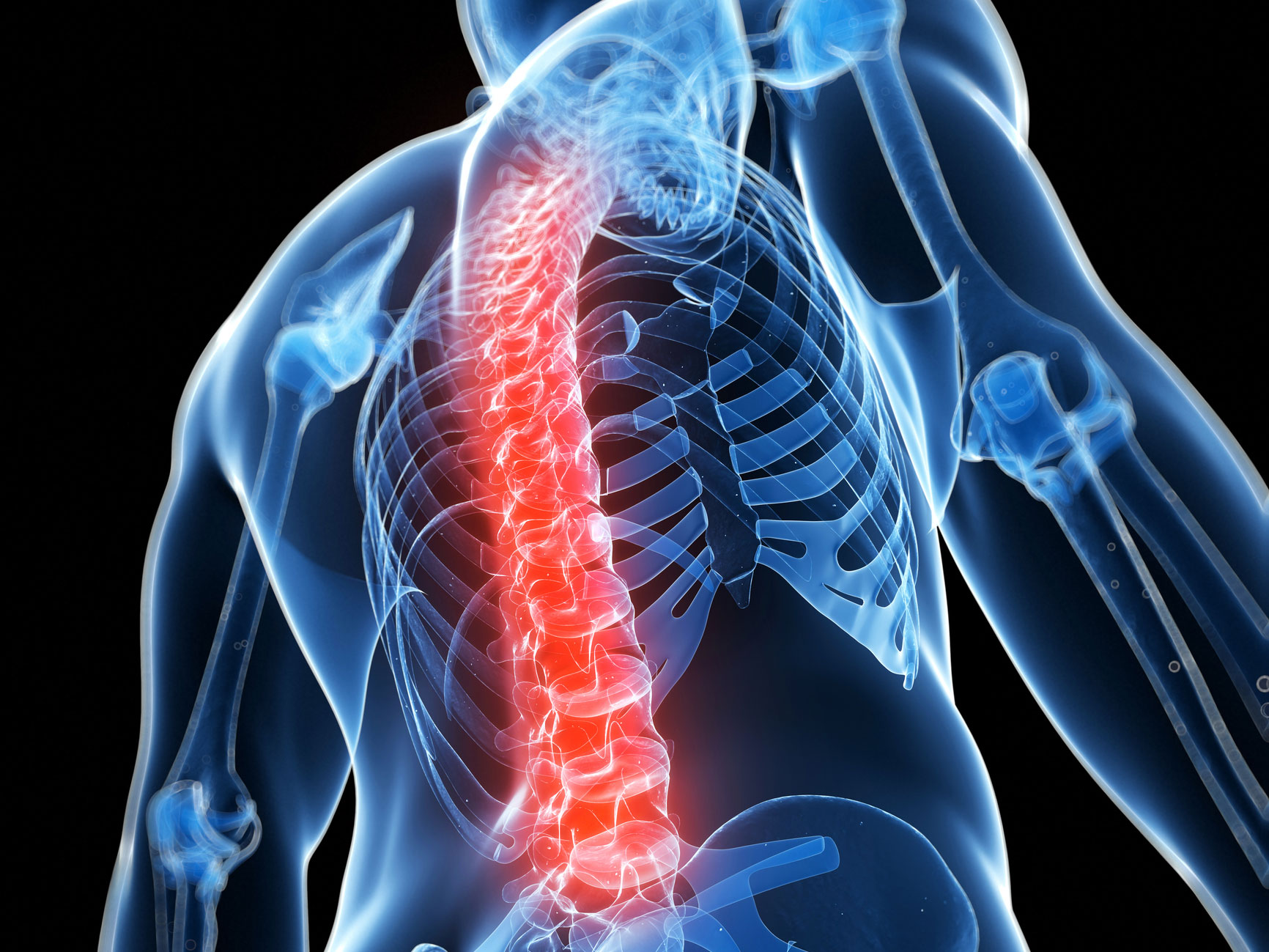 Is your back pain a sign of Ankylosing Spondylitis?