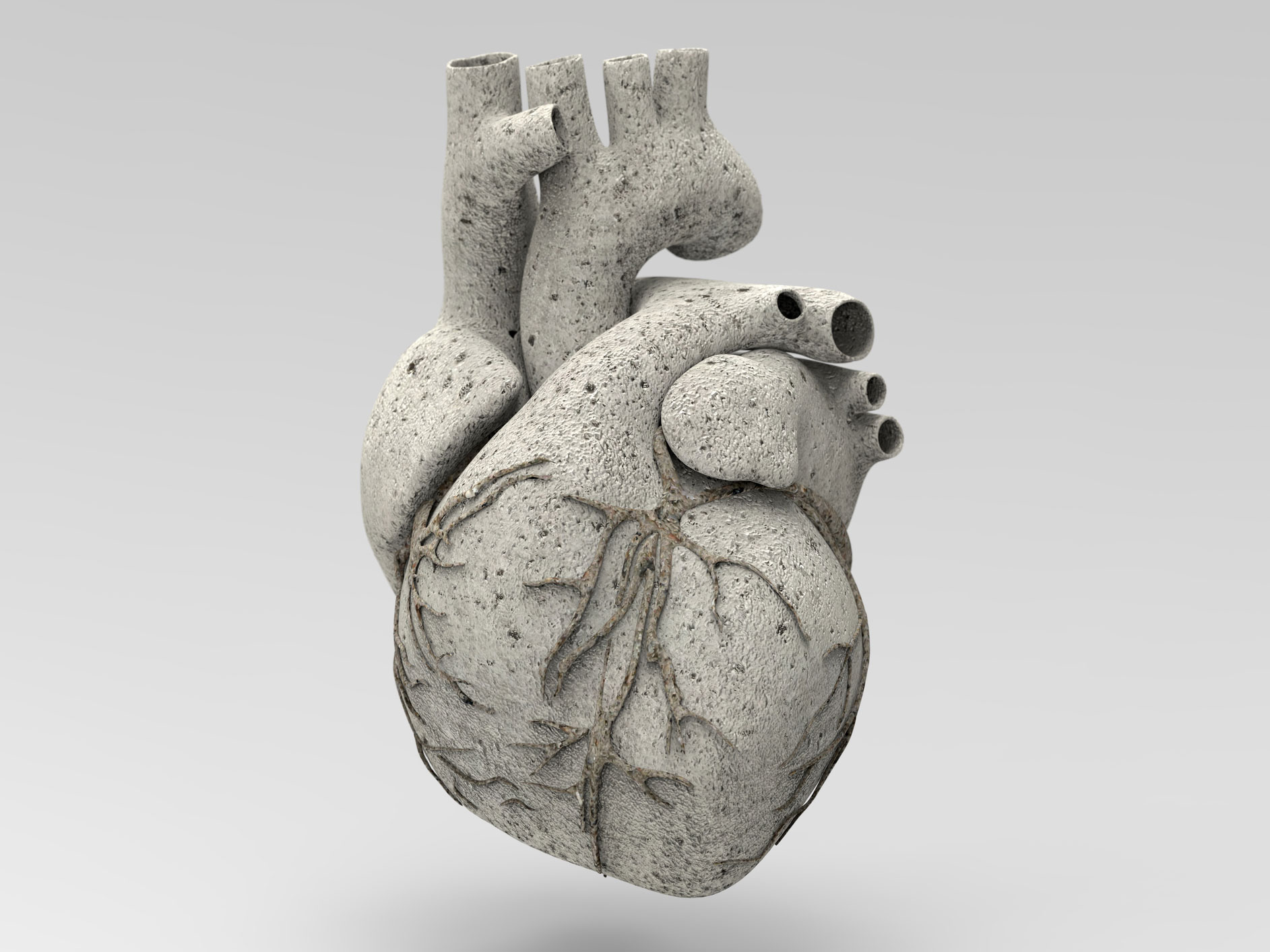 What you need to know about coronary calcium scans