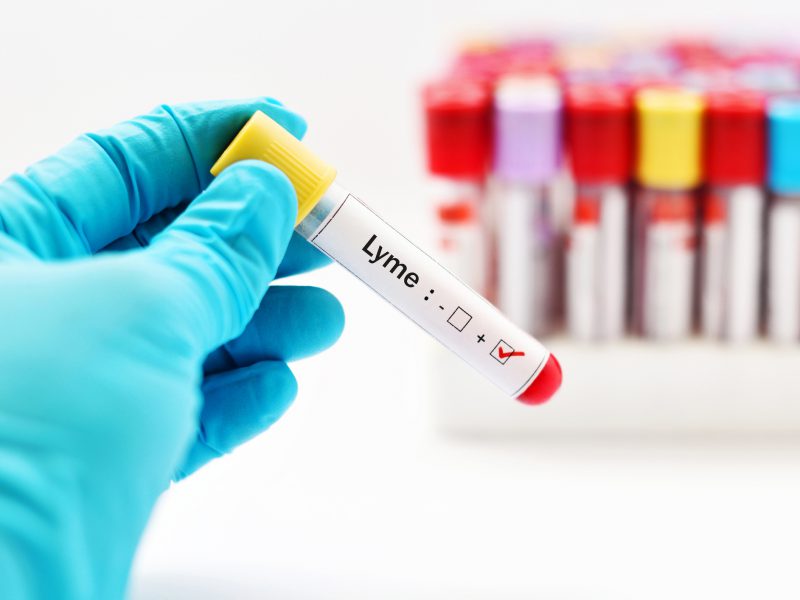 Improving the accuracy of Lyme disease testing Easy Health Options®