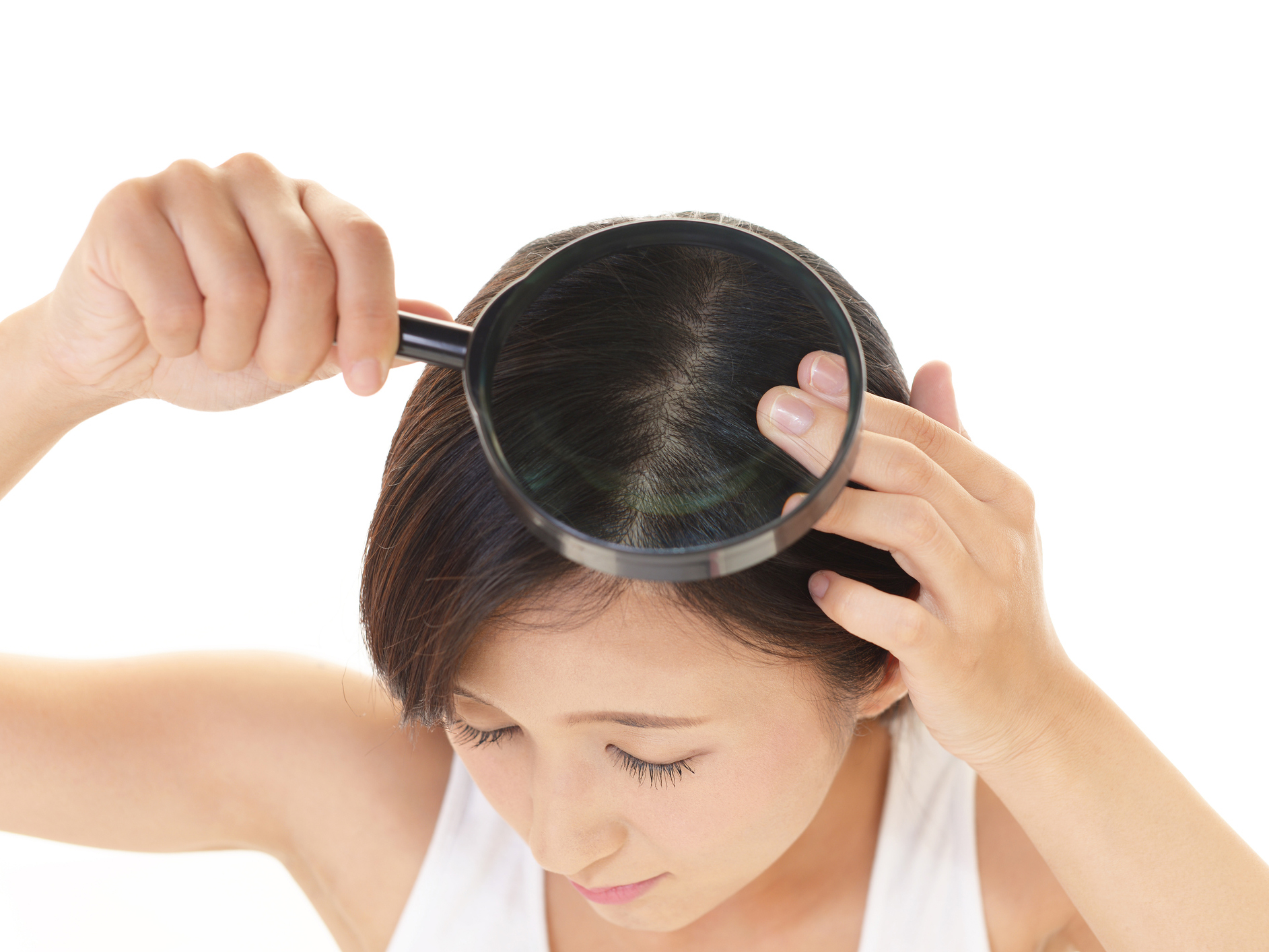 Why melanoma may have more to do with your hair than skin