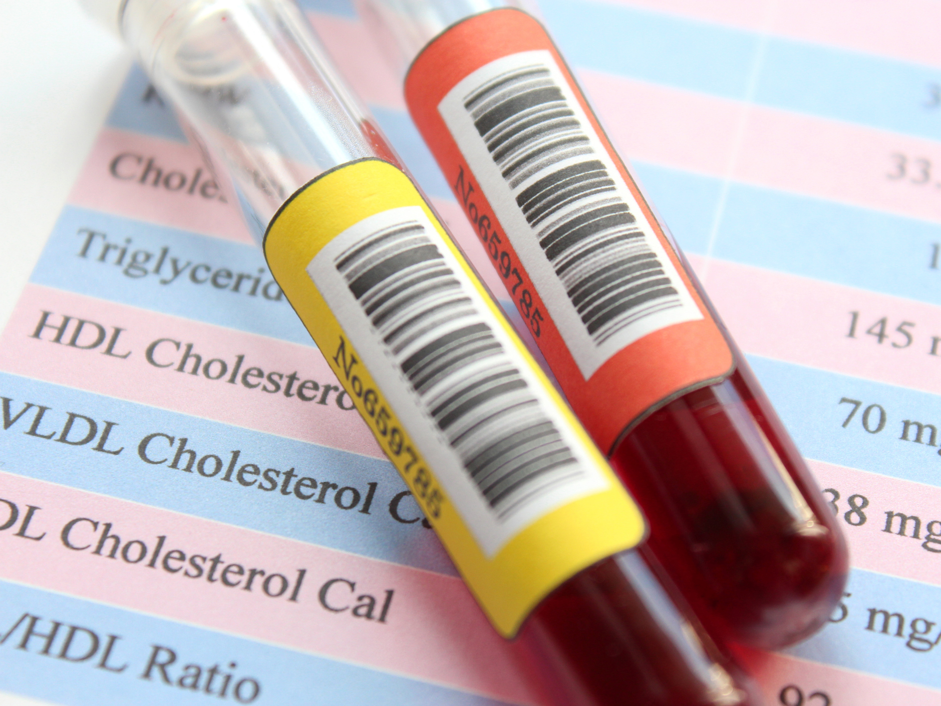 What really matters about cholesterol in the big scheme of things