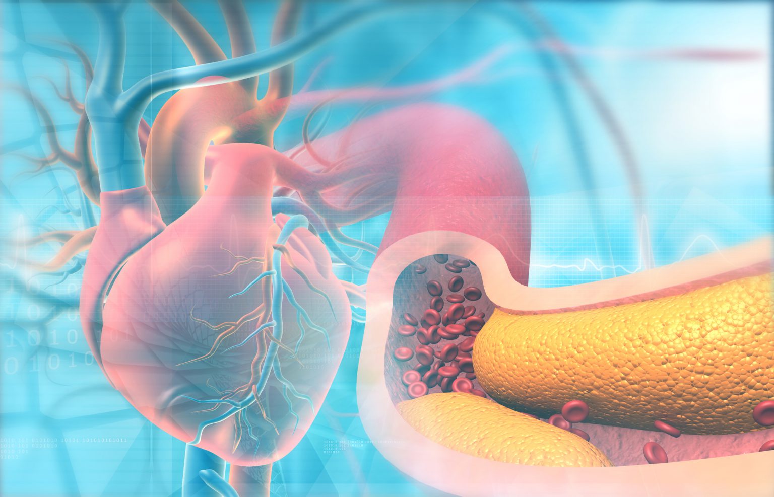 HDL protects against narrowing of the arteries Easy Health Options®