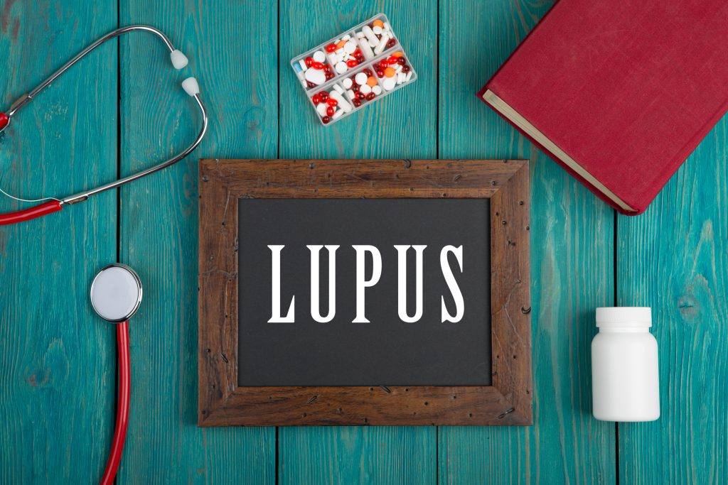 Living with Lupus: The vitamin deficiency you can’t afford to ignore