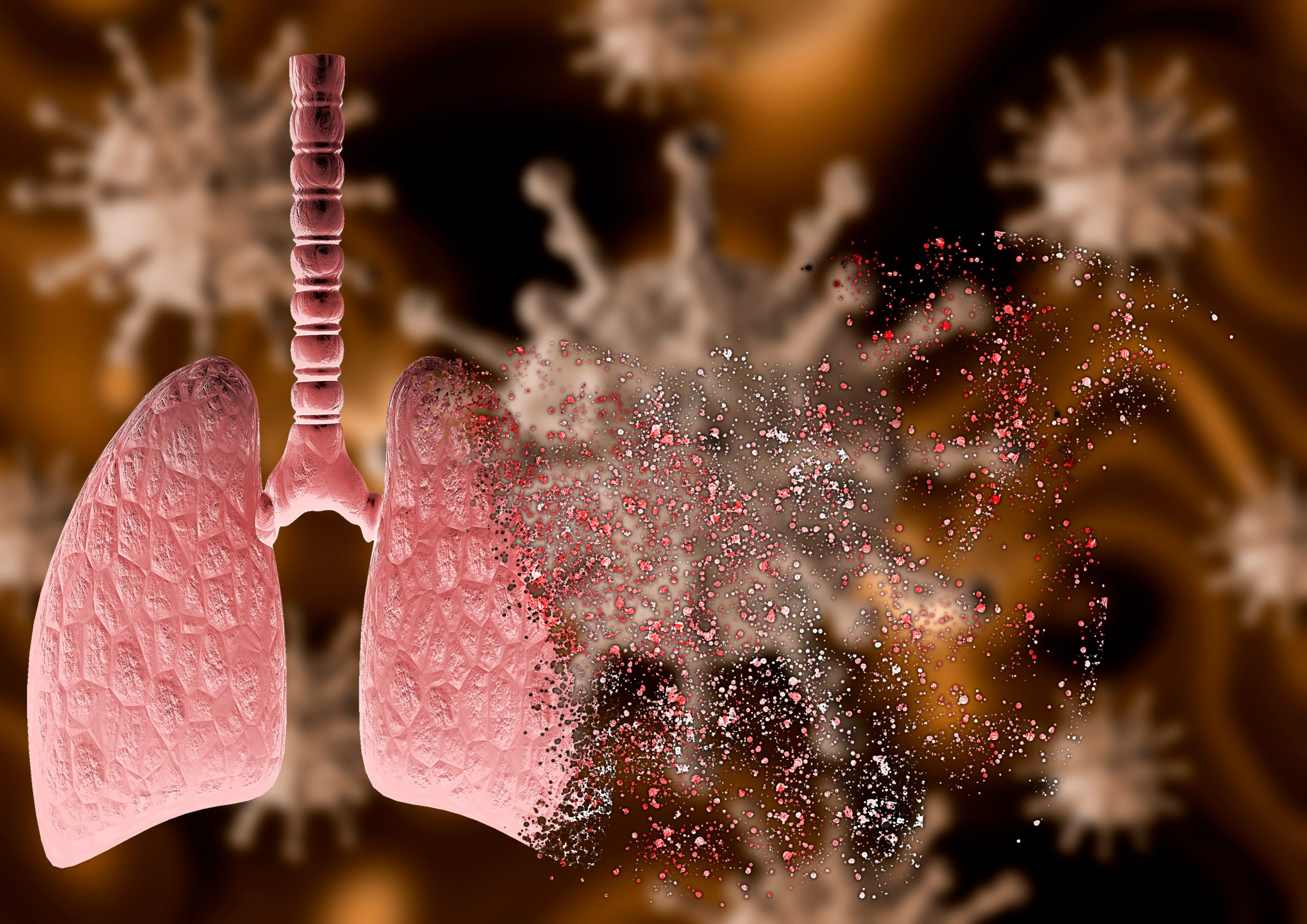 COVID-19 and our lungs: Double the viral load and a glitch in the immune system