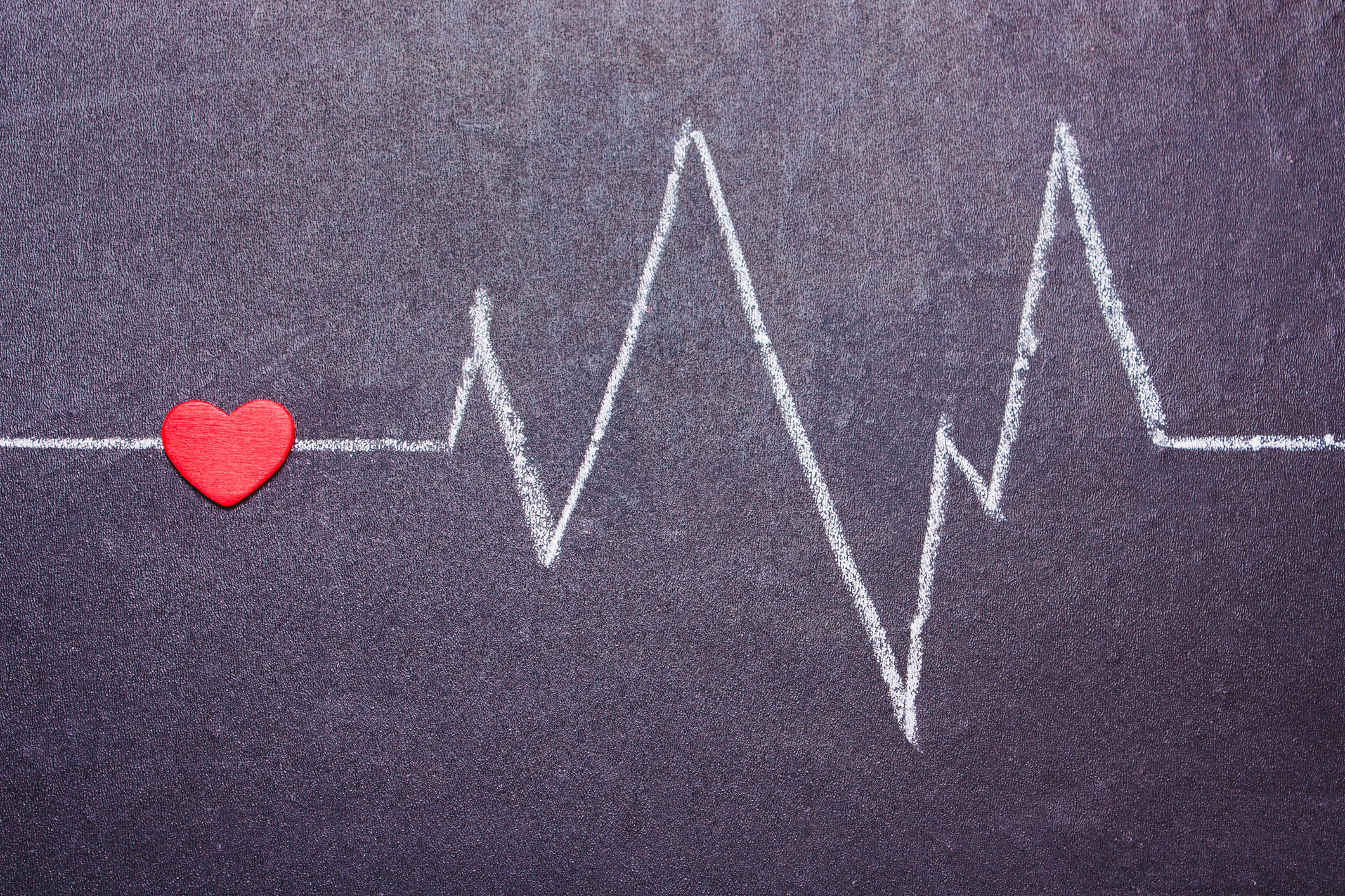 The unexpected truth behind AFib triggers