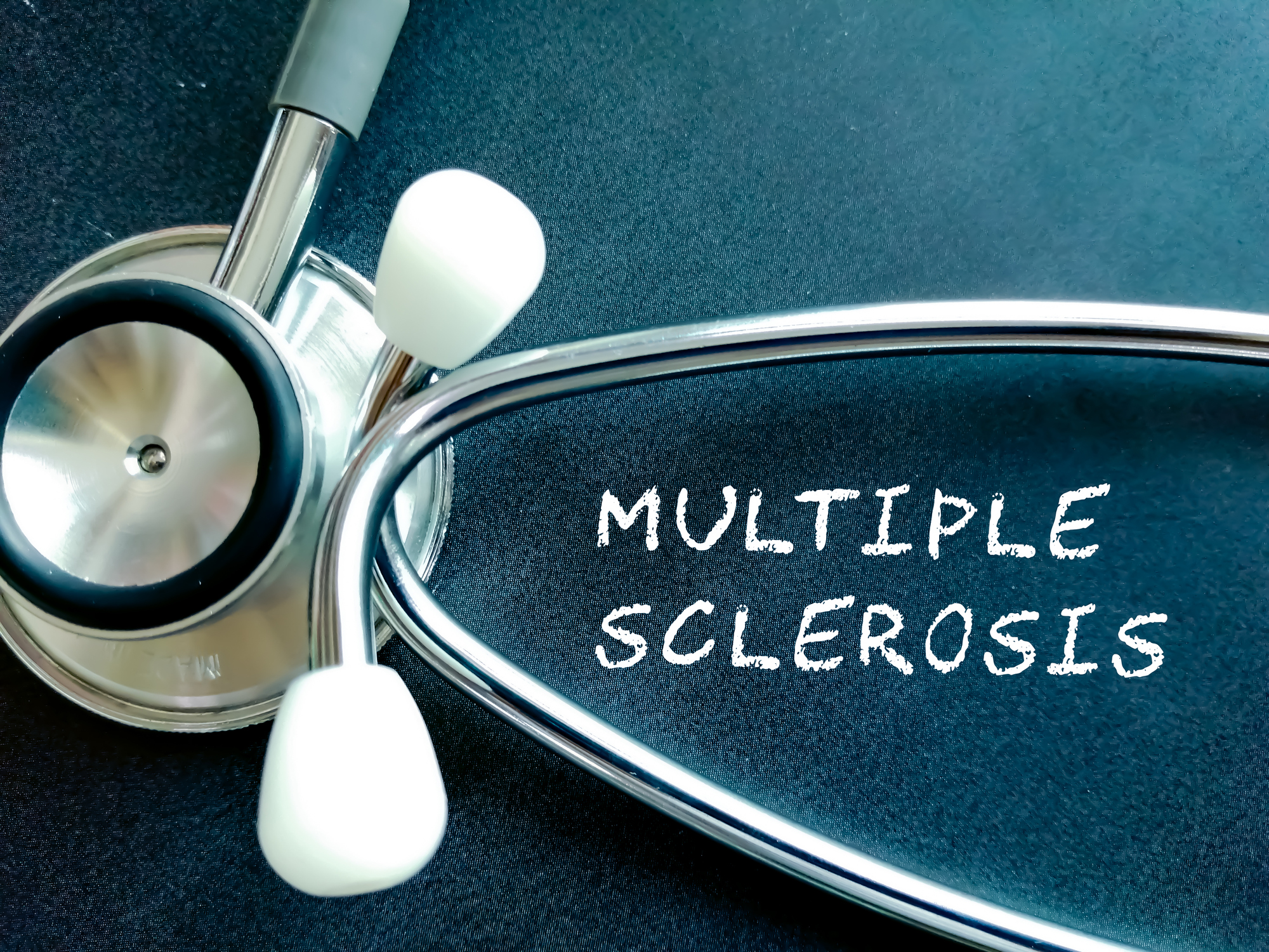 Viral trigger to blame for Multiple Sclerosis