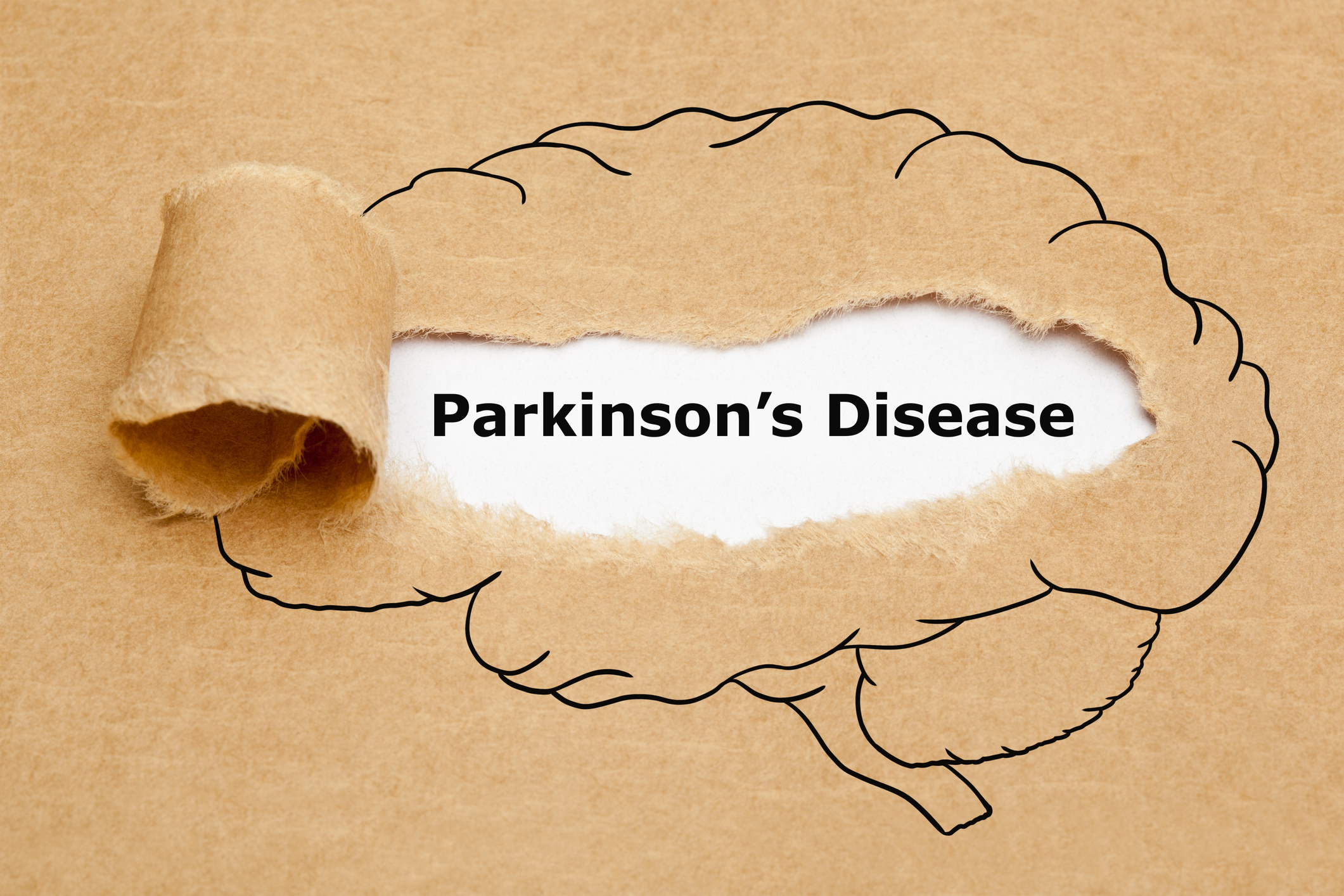 Hormone found to stop a key trigger of Parkinson’s