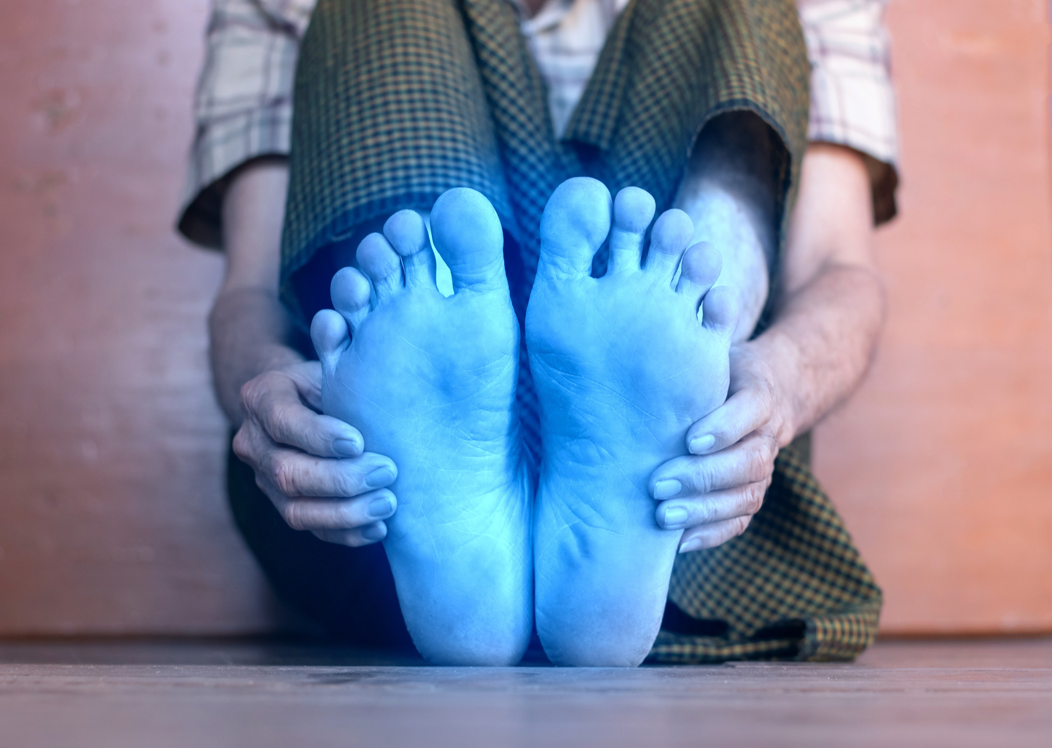 Blue legs syndrome: The latest long COVID symptom