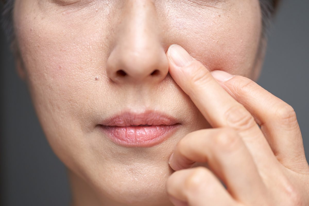 Acne is more than just a skin problem