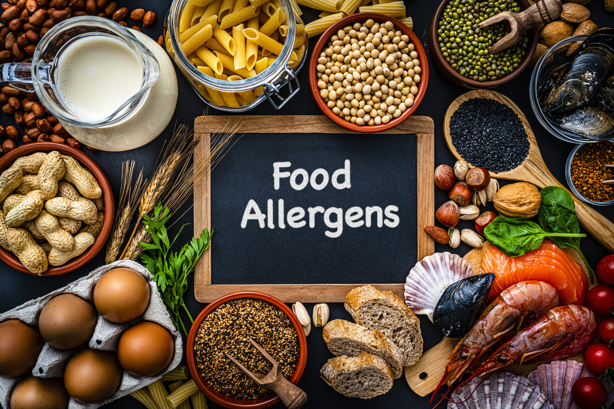 Food allergy testing could relieve your health woes