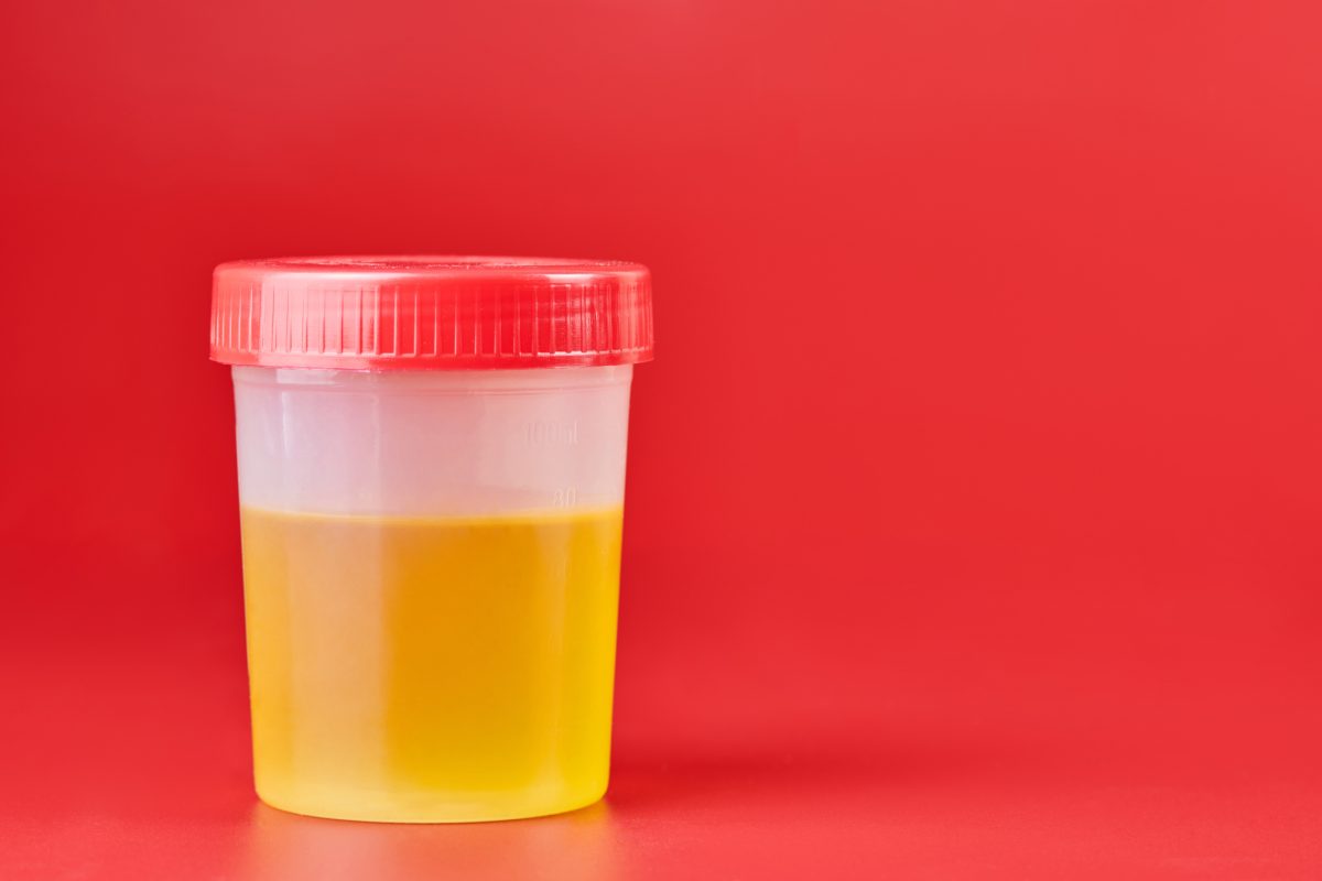 When your urine test finds heavy metals and heart trouble