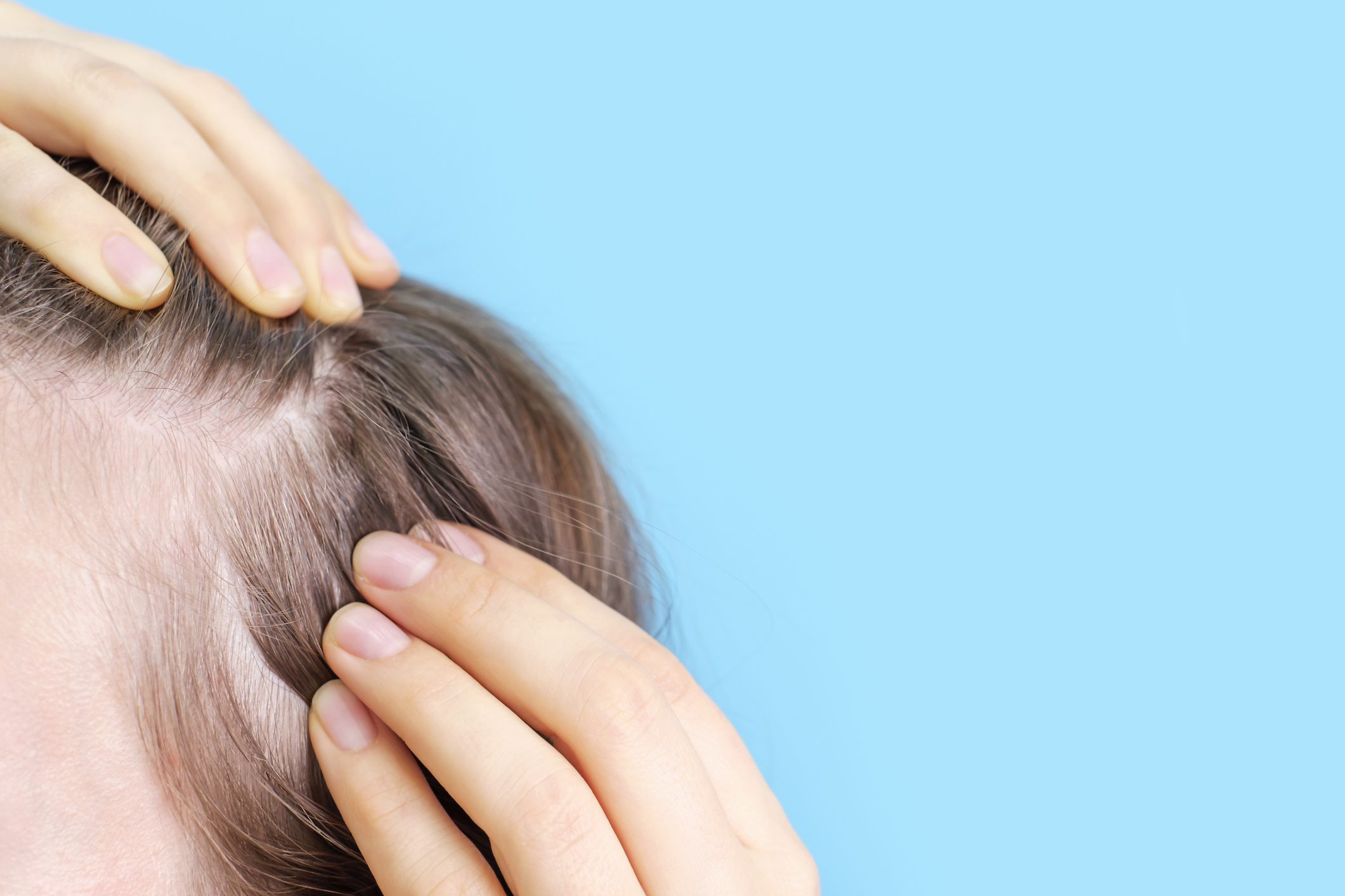 Sweet news about safer treatments for hair loss