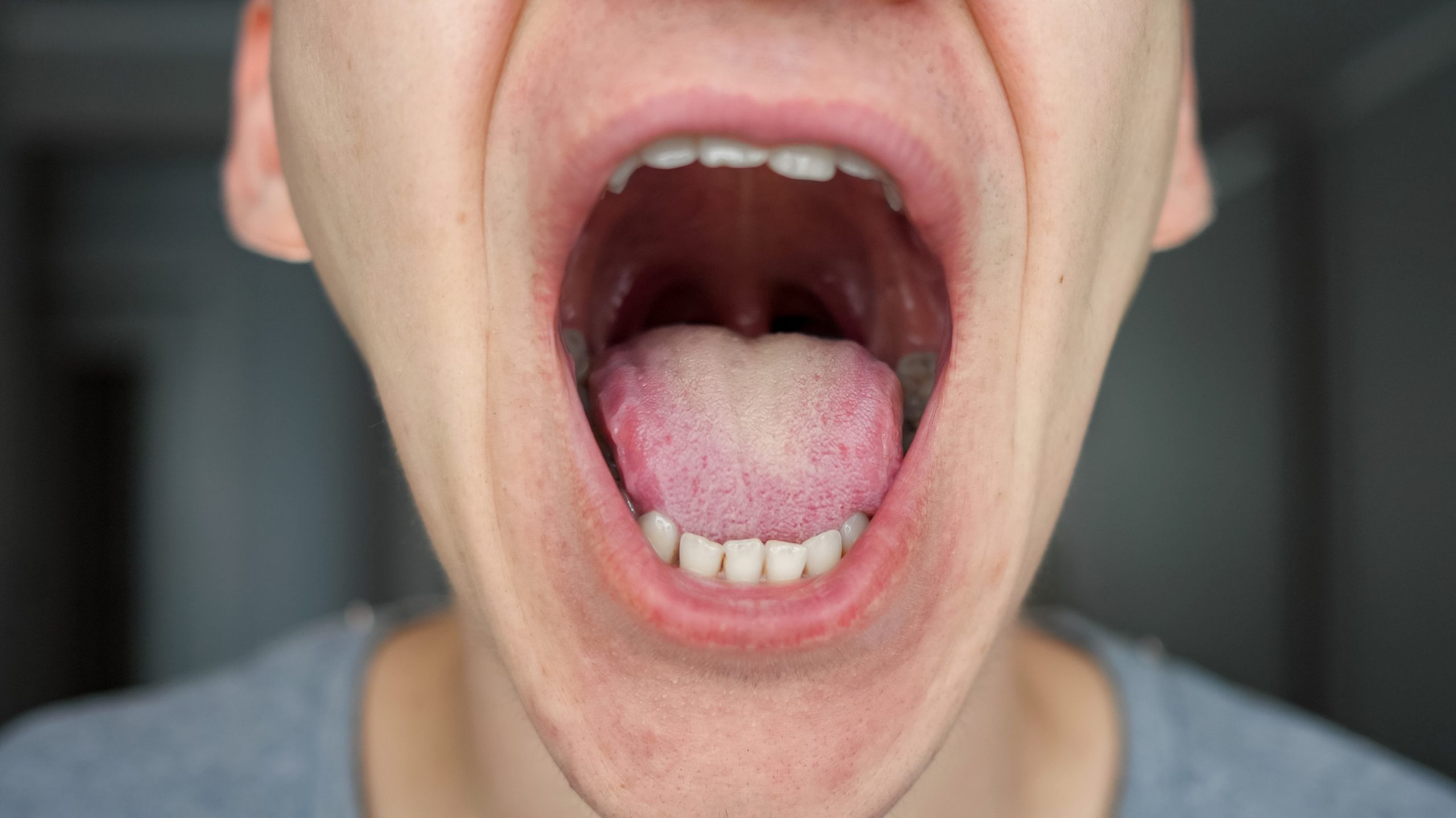 How bacteria linked to gum disease increase cancer risk