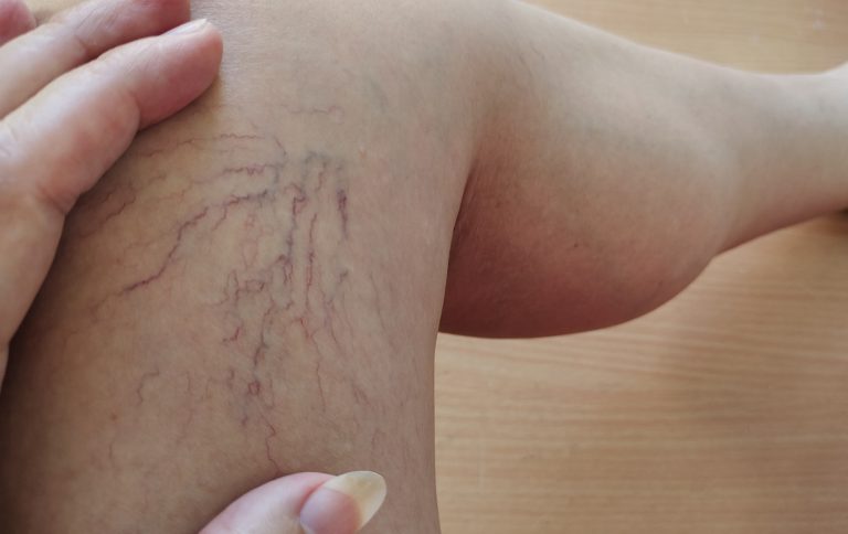 9 signs of poor circulation you shouldn’t ignore