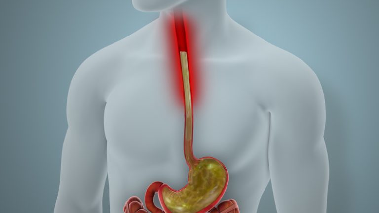 Heartburn relief that leads to bone loss and anemia