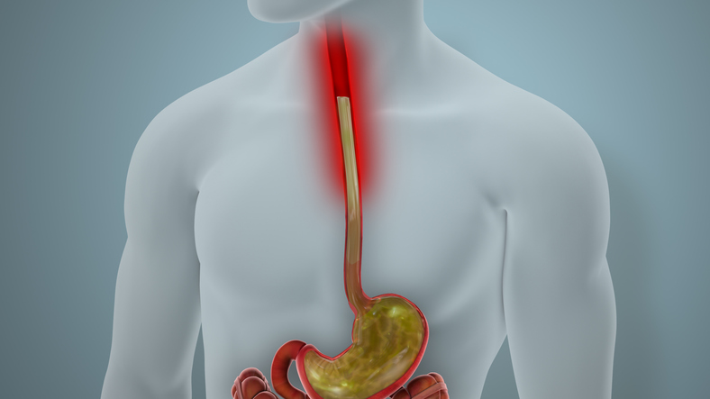 Heartburn relief that leads to bone loss and anemia